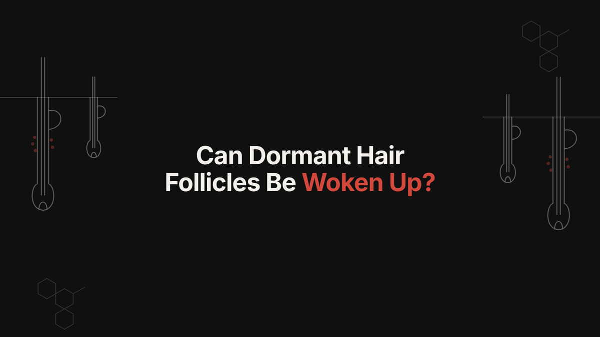 Can Dormant Hair Follicles Be Woken Up? The Stem-Cell Science Behind a New Hair Loss Trial