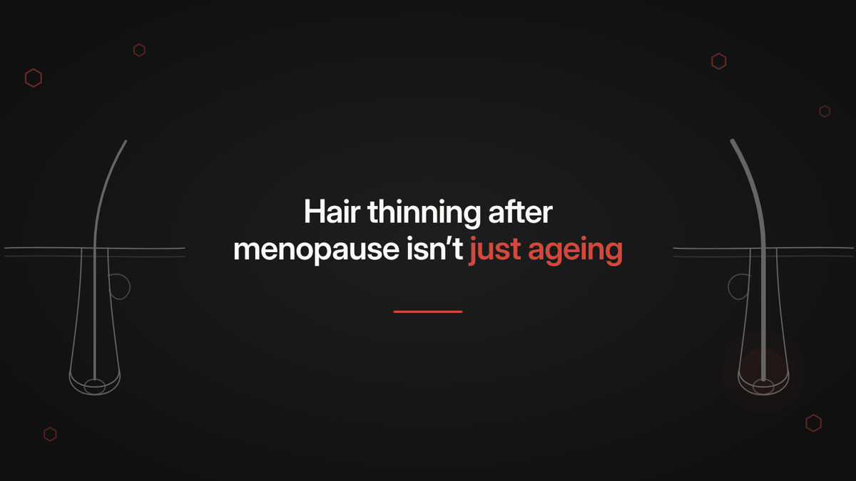 Hair Thinning After Menopause Isn't Just Ageing: What a New Topical Finasteride Study Adds