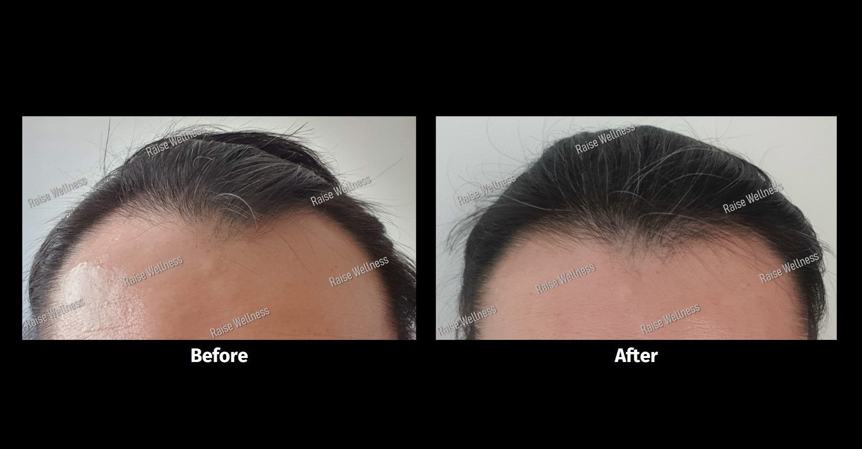 Fight hair loss, regain healthy hair growth